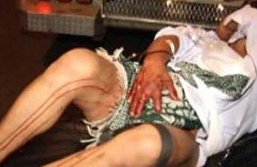 Tự tay cắt phăng "của quý" sau khi uống "bia cỏ"