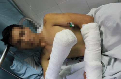 Nửa đêm, côn đồ đạp cửa xông vào truy sát người vô tội