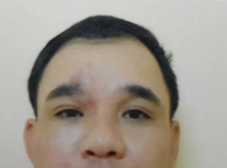 "Diễn kịch” tại quán bia, nhằm đòi tiền bảo kê