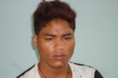 Trai làng đâm xuyên ngực nhau, tại đám cưới