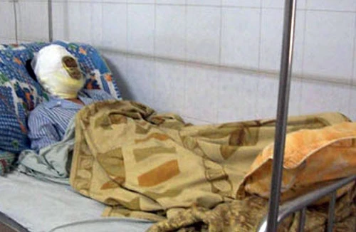 Tạt a xít trả thù bạn nhậu