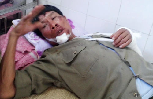 Trộm chó bị phát hiện, lao thẳng xe vào bảo vệ tổ dân phố