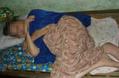 Bà cụ 85 tuổi đang ngủ bị cướp vàng