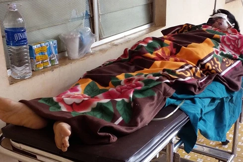  Bình gas mini phát nổ, nam thanh niên dập nát bàn tay