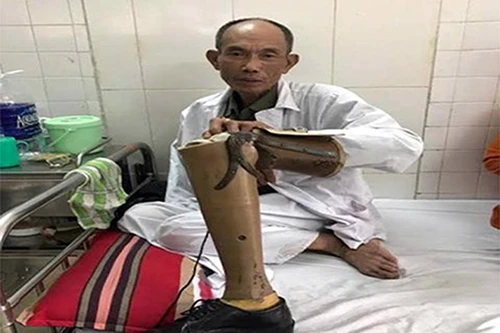 Thăm hỏi thương binh bị nhóm thanh niên hành hung sau khi va chạm giao thông