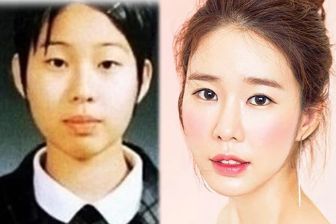 [ẢNH] Bất ngờ trước hành trình "dao kéo" của 4 mỹ nhân xứ Hàn