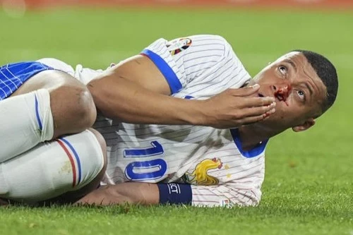 Mbappe gặp họa, nhập viện khẩn cấp trong chiến thắng của Pháp
