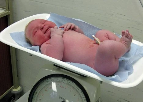 Bé sơ sinh nặng tới 6,5 kg