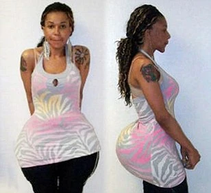 Kinh hoàng vụ độn vòng 3 bằng xi-măng và cao su