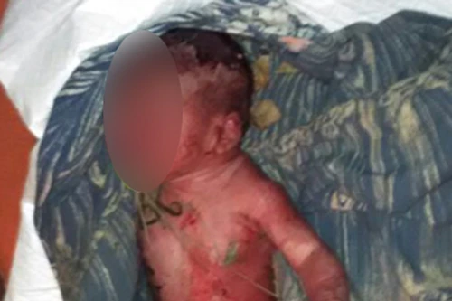 Đáng thương bé gái sơ sinh bị bỏ rơi trong thùng rác, kiến bu đầy