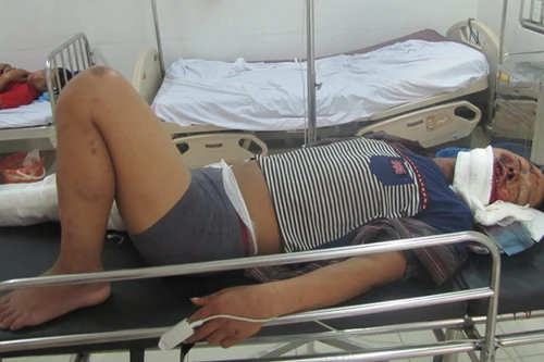 Sập giàn giáo ở dự án Formosa, 2 người chết, 3 người trọng thương