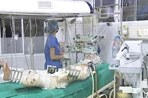 Hội chẩn liên viện tìm giải pháp điều trị 3 chiến sỹ trong vụ máy bay rơi