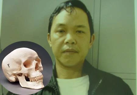 Kỳ án "sọ người" và hành trình hơn 60 ngày đêm phá án