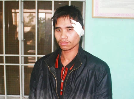 Án mạng từ cái "nhìn đểu"