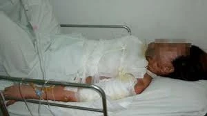 Em nợ 1 triệu đồng, anh nhẫn tâm tạt dầu sôi!