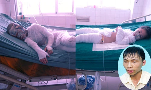 Giáp mặt gã trai hắt cả xô axit vào gia đình ông chủ