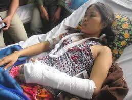 Nỗi ám ảnh kinh hoàng của người bị chồng cũ rạch mặt, cắt gân tay