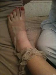 Sự thực phía sau “công nghệ” lột da, tắm trắng