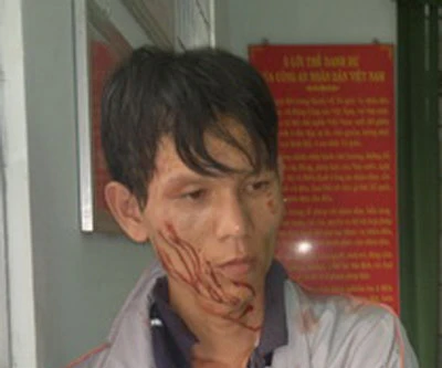 Trọng án ở Đồng Nai: Thiếu nợ 800 ngàn đồng nên làm liều?