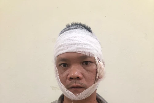 Mâu thuẫn gia đình, người đàn ông dùng dao chém bố và anh trai thương vong