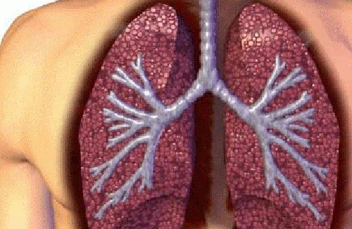 Vaccine ung thư phổi ra đời