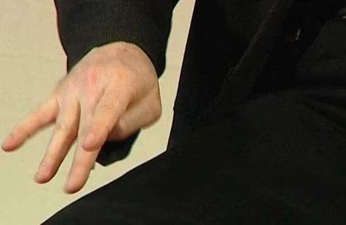 Dấu hiệu sớm của bệnh Parkinson