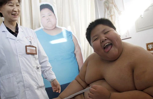 Điều trị cho bé 10 tuổi nặng 155kg