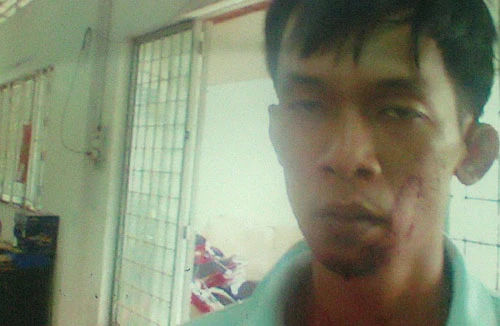 Khởi tố, bắt giam CSCĐ tấn công CSGT giữa phố