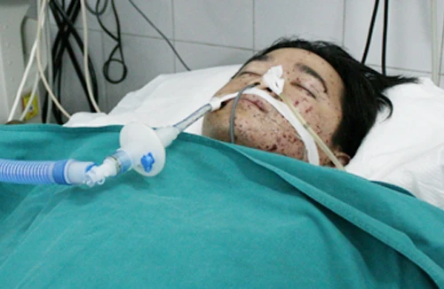 Tình yêu hay sự thù hận?