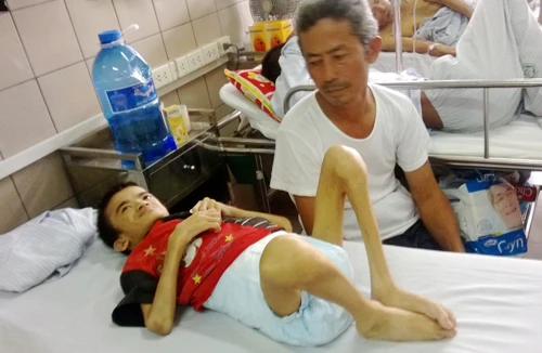 Bệnh nhân 26 tuổi nặng... 16 kg 