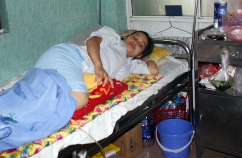 2 sản phụ bị liệt sau sinh mổ