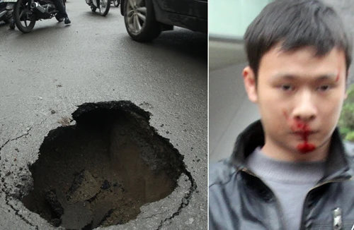 Một người phải nhập viện vì “hố tử thần” 