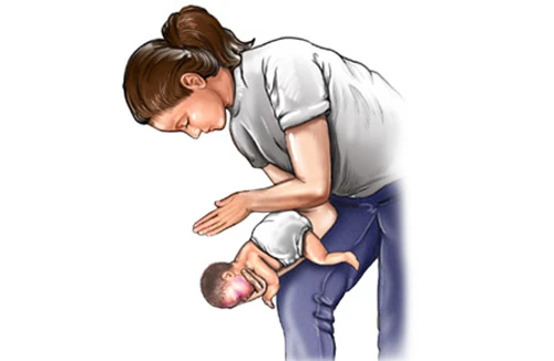 Cấp cứu khi trẻ nuốt phải dị vật