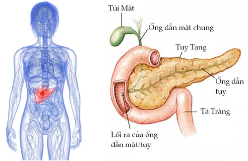 Dấu hiệu bất thường cảnh báo ung thư tuyến tụy