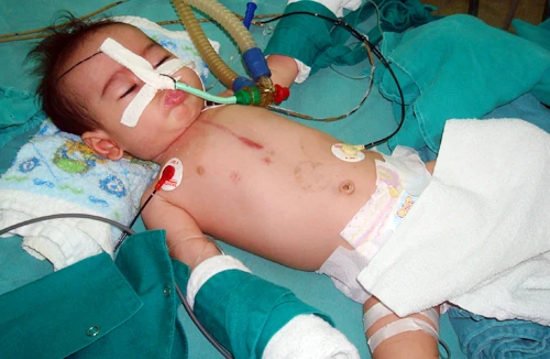 Điều trị thành công ca bệnh hiếm gặp