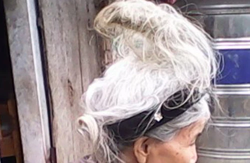 Vì sao con người lại mọc sừng?