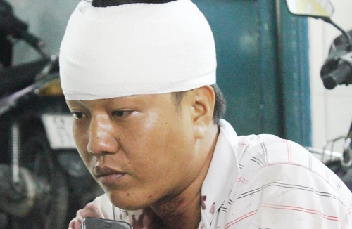 Đâm đồng nghiệp gần 30 nhát dao