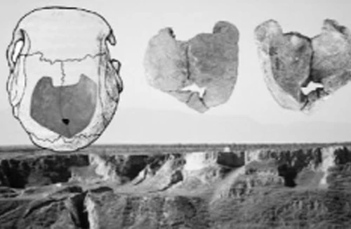 Lỗ thủng ở hộp sọ: Dấu hiệu hôn nhân cận huyết thống