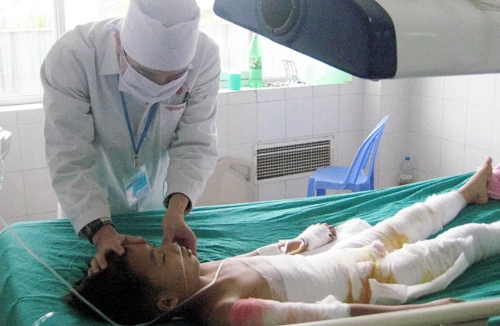 Nhiều trẻ nguy kịch vì bỏng
