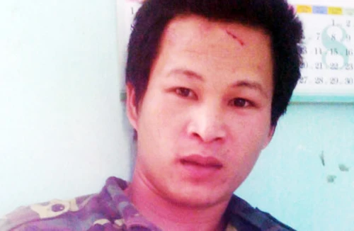 Ghen vợ, hành hung... anh rể