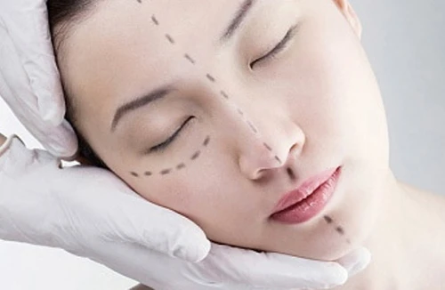 Phẫu thuật chỉnh hình khó tăng quyến rũ