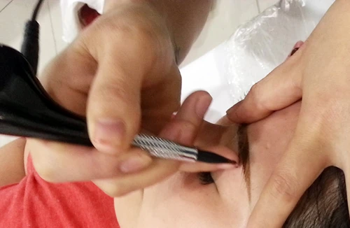 Cái giá của nhan sắc... dao kéo