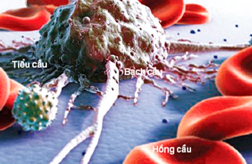 Ung thư máu trẻ em ngày càng tăng nhanh