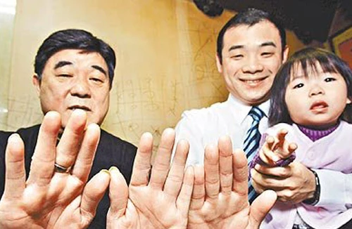 Người không có dấu vân tay