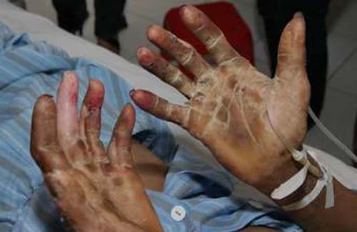 Ăn tiết canh lấy “đỏ”, bỏ mạng