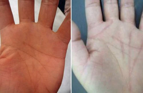 Vẽ lại đường chỉ tay, mong vận đỏ