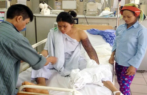 Gia tăng bệnh nhân bị rắn độc cắn