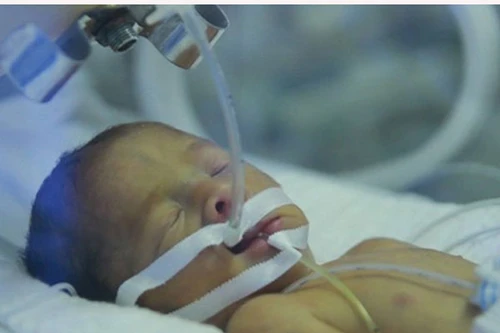 Mẹ ung thư nhường sự sống: Cuộc đời tặng hết cho con