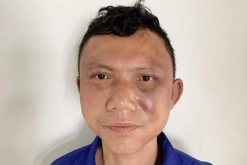 Trò lừa đảo của gã đàn ông nghiện rượu