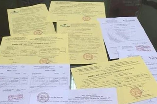 Nhà xe câu kết thợ ảnh sản xuất giấy test nhanh Covid